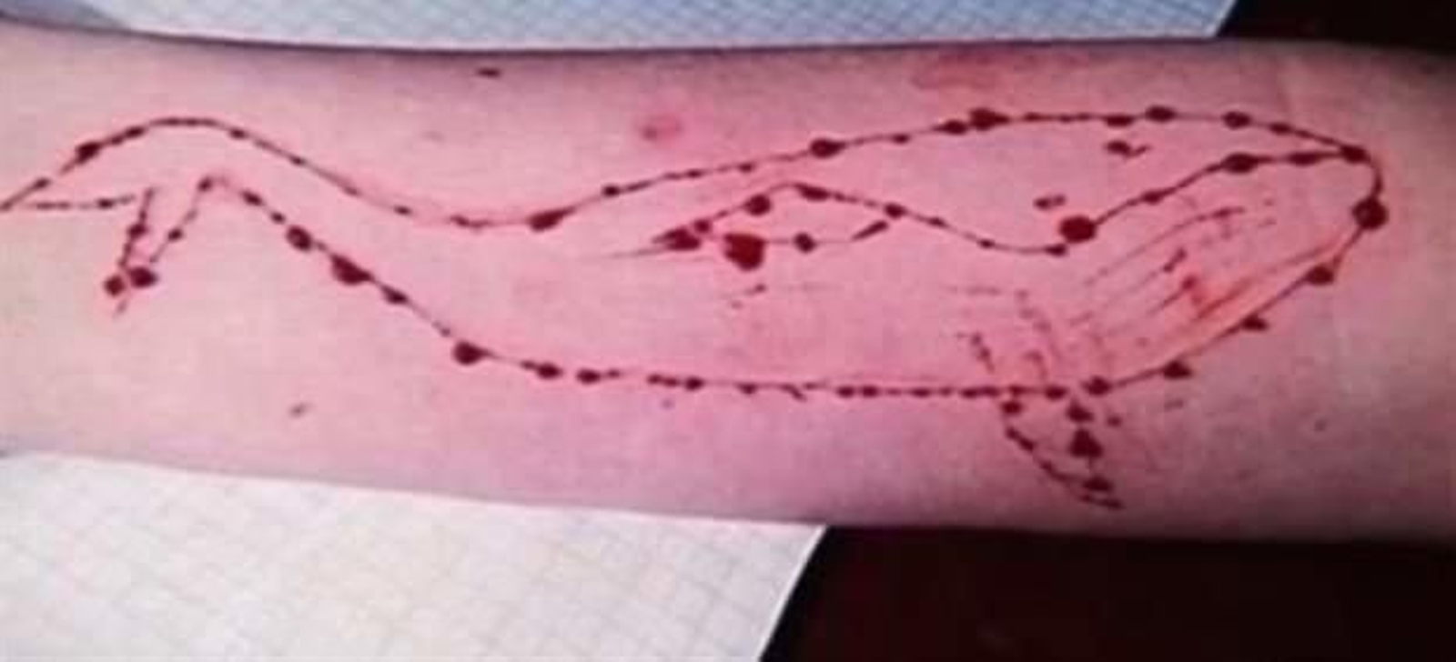 Una de la pruebas del supuesto reto viral es cortarse la piel de forma que se dibuje un cetáceo azul.