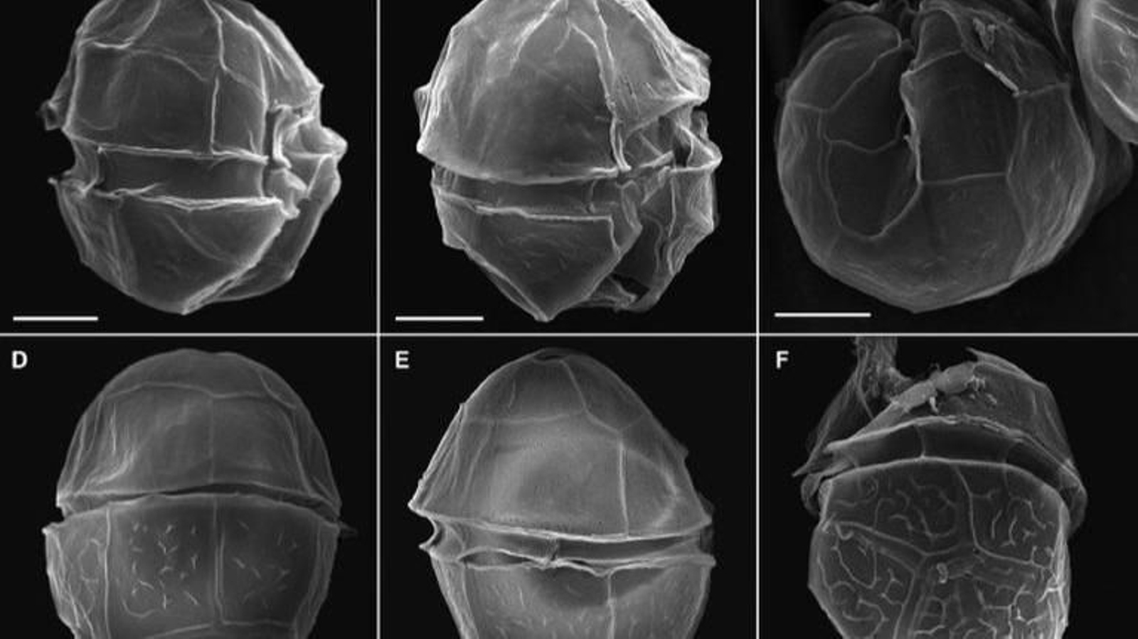 Las imágenes del Alexandrium Fragae.