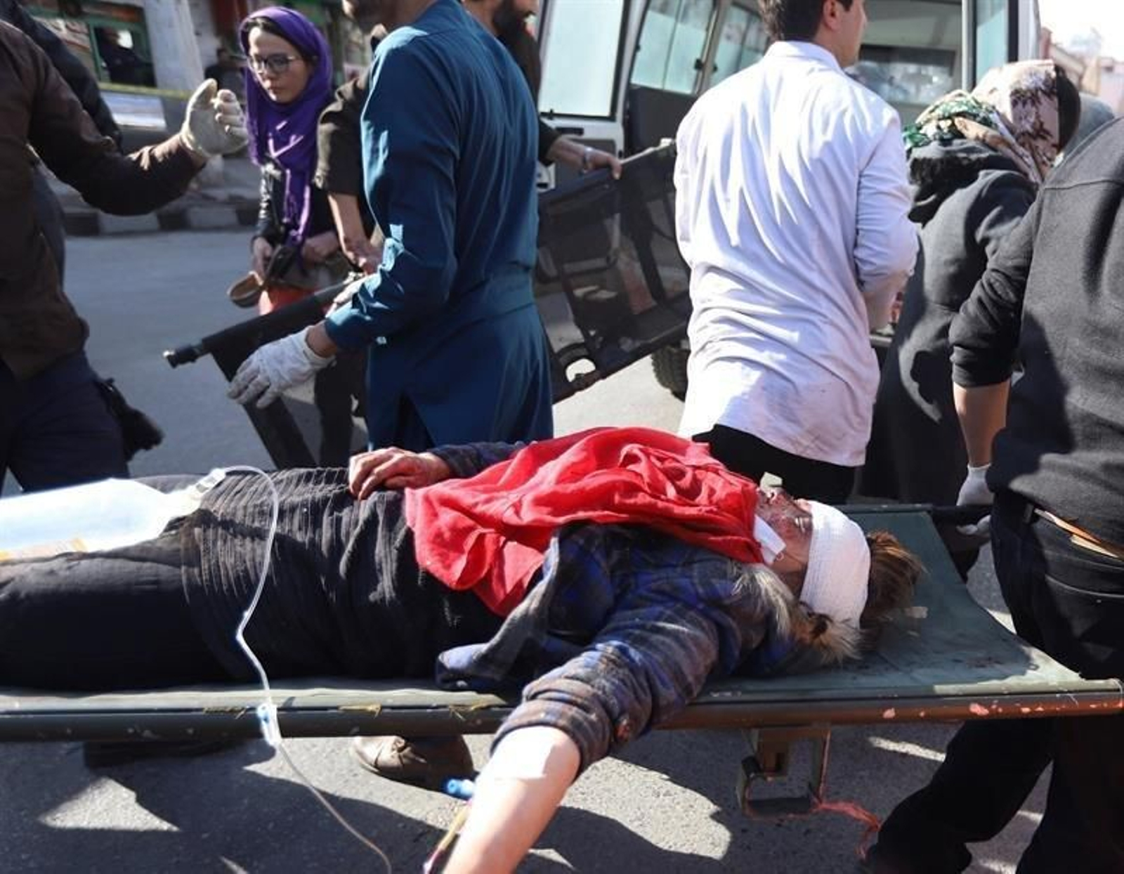 Un herido en la explosión es trasladado a un hospital en Kabul