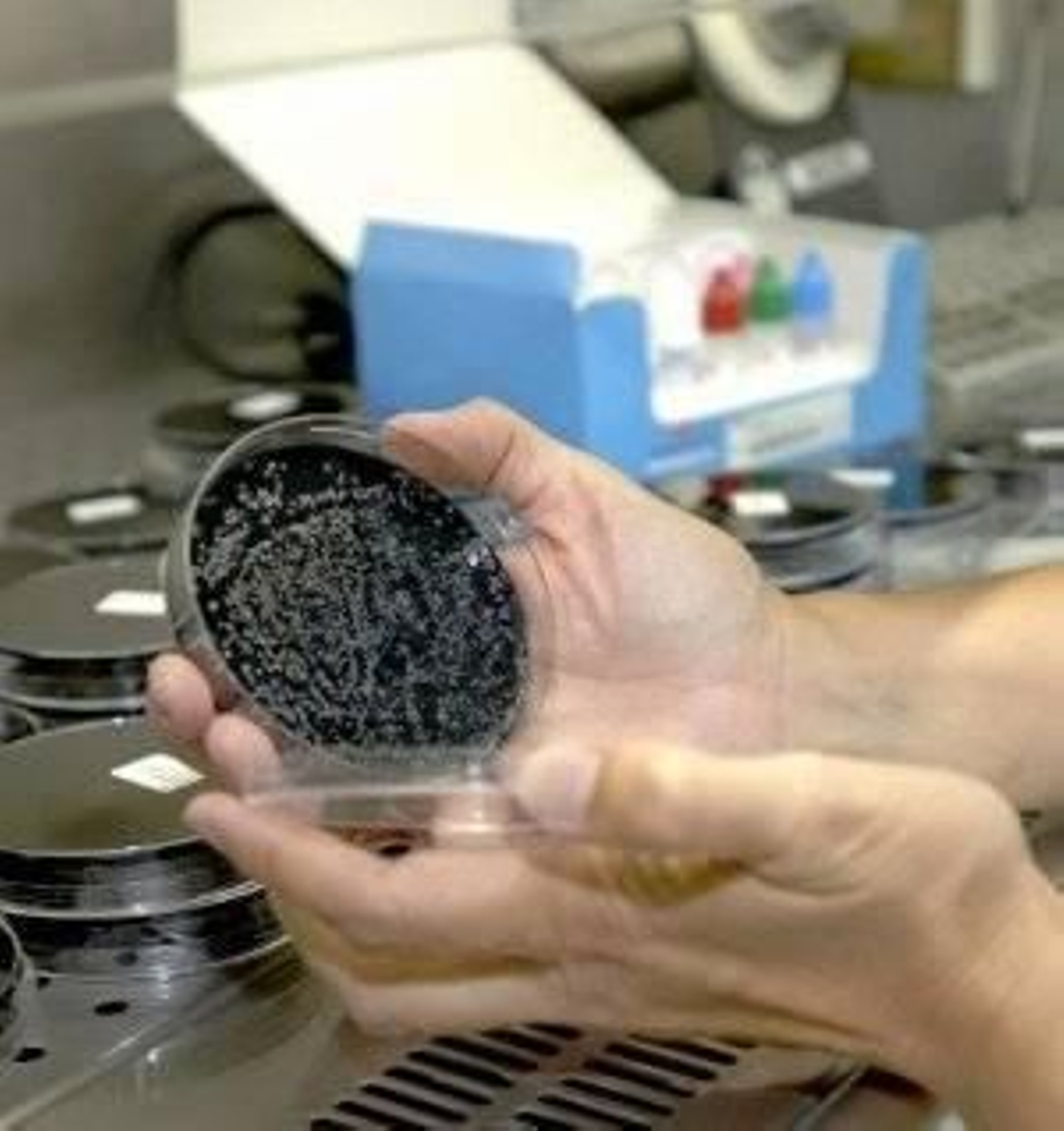 Una técnica enseña una muestra con positivo en legionela (Foto: Archivo EFE)