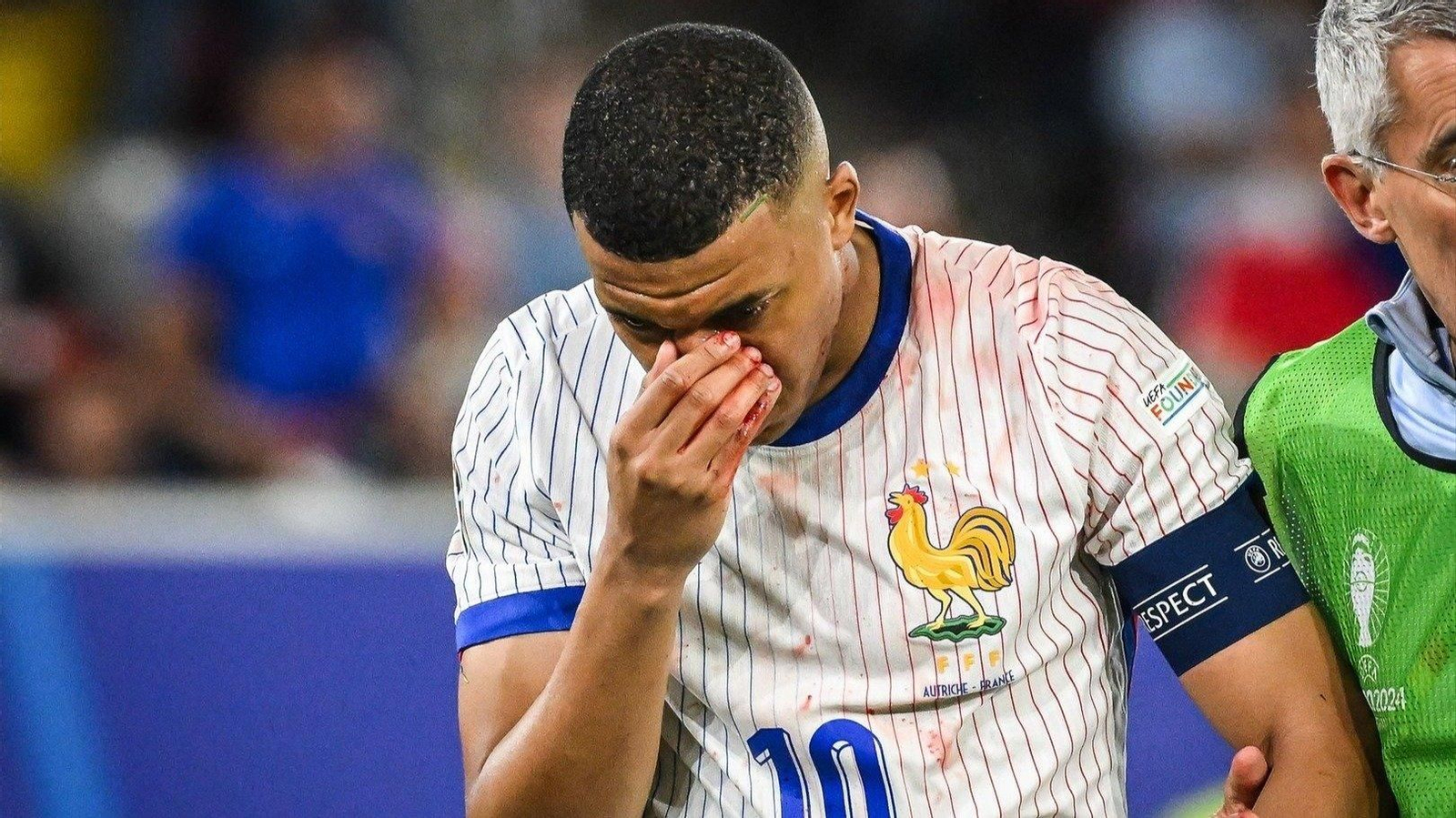 Mbappé sangra por la nariz. // E.P.