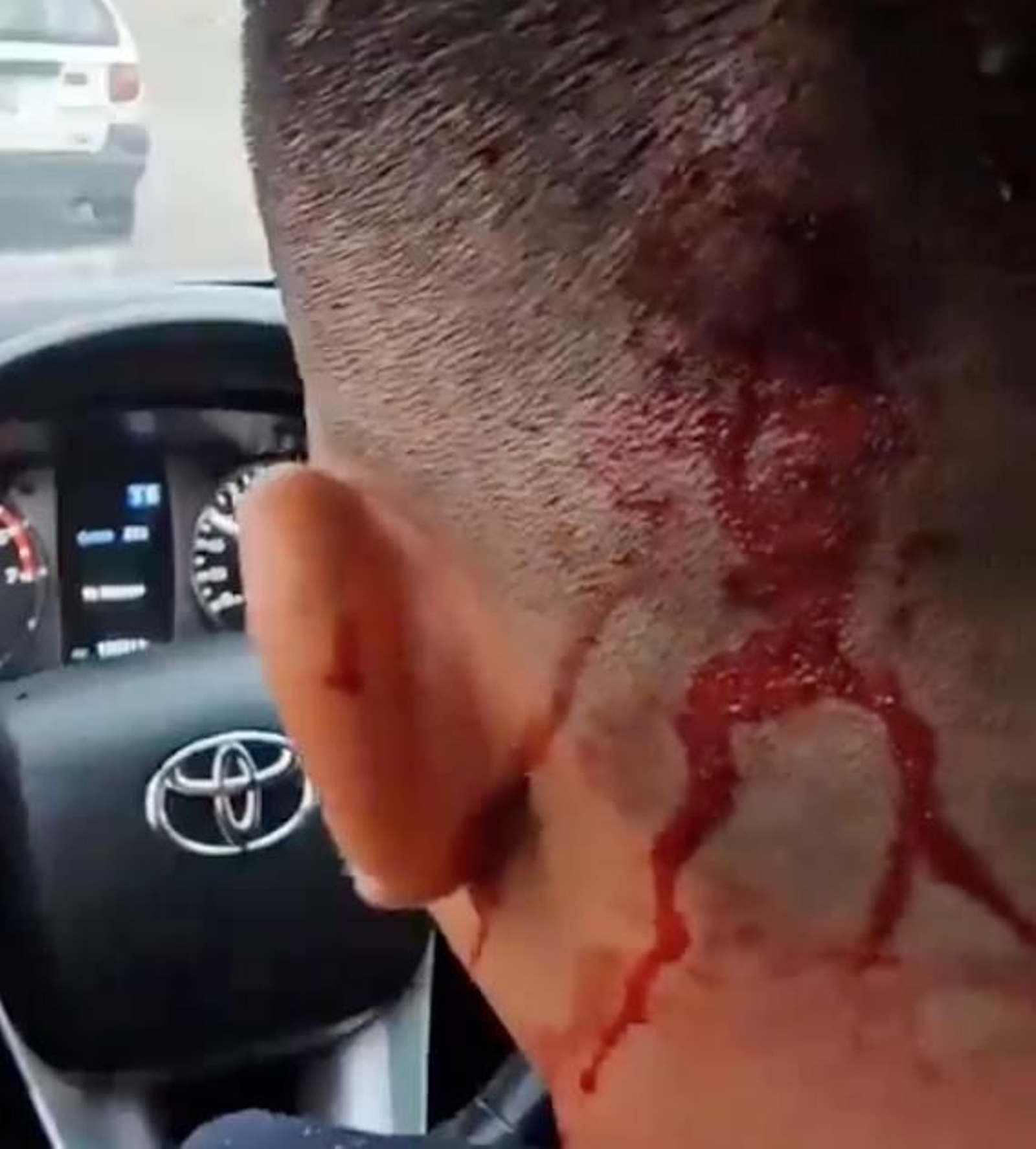 Imagen difundida en redes sociales de las heridas sufridas por  conductor del vehículo en el que viajaba Evo Morales tras resultar tiroteado.