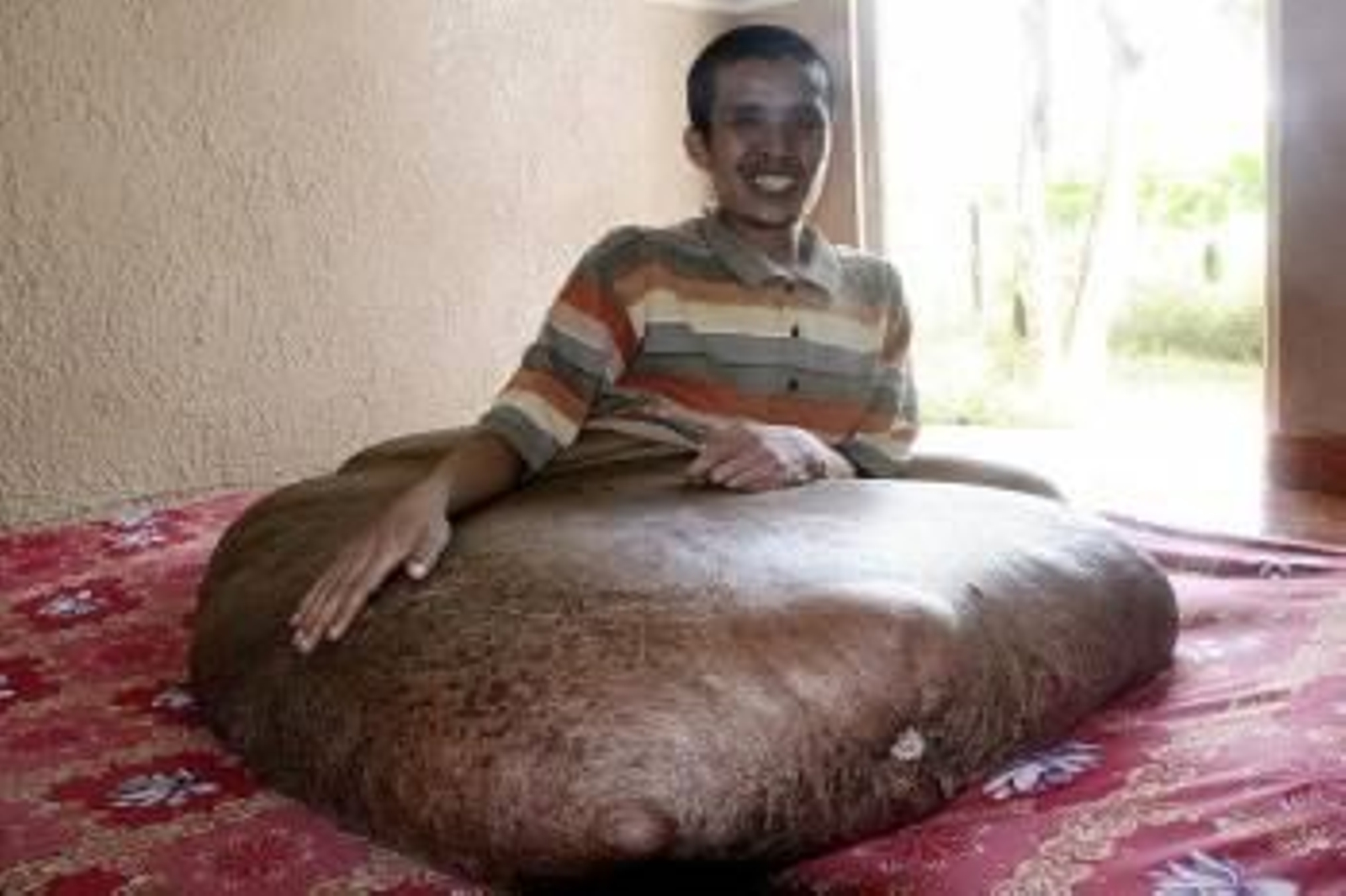 Fotografía de archivo (15 de junio de 2011) que muestra a Nguyen Duy Hai, un vietnamita con un tumor de 90 kilos en su pierna derecha, junto a su madre. (Foto: EFE)