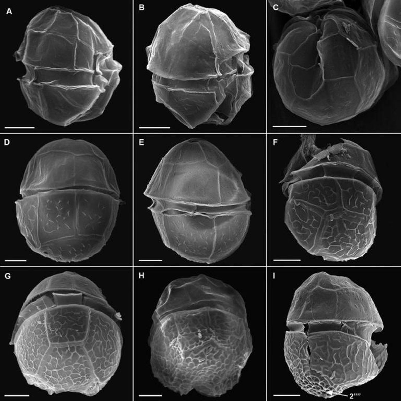 Las imágenes del Alexandrium Fragae.