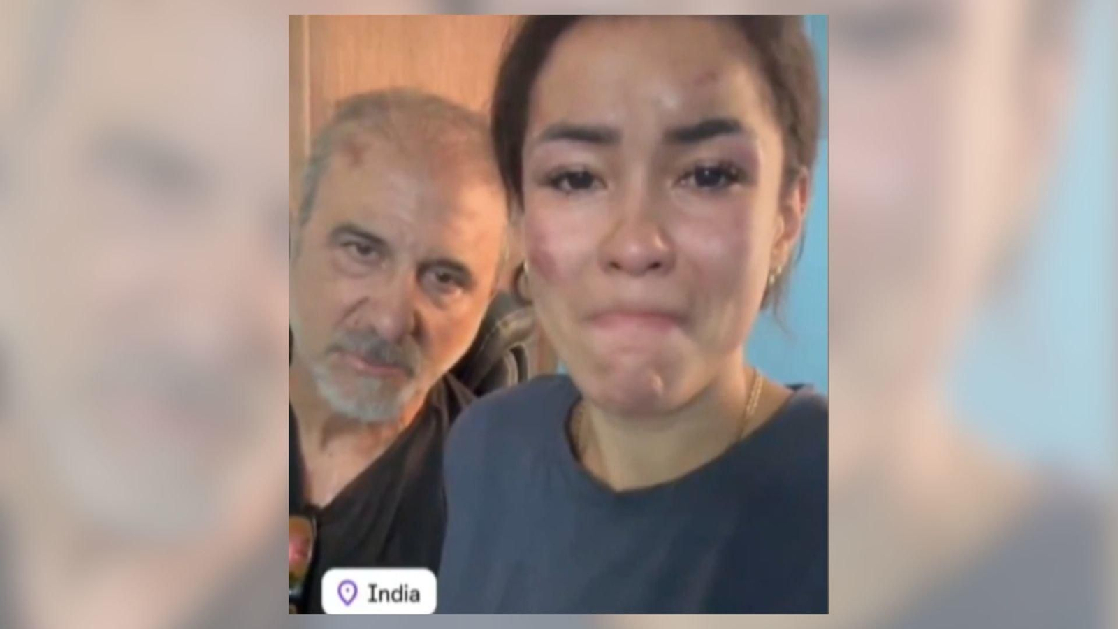 La mujer y su pareja muestran las heridas tras sufrir un ataque en India.