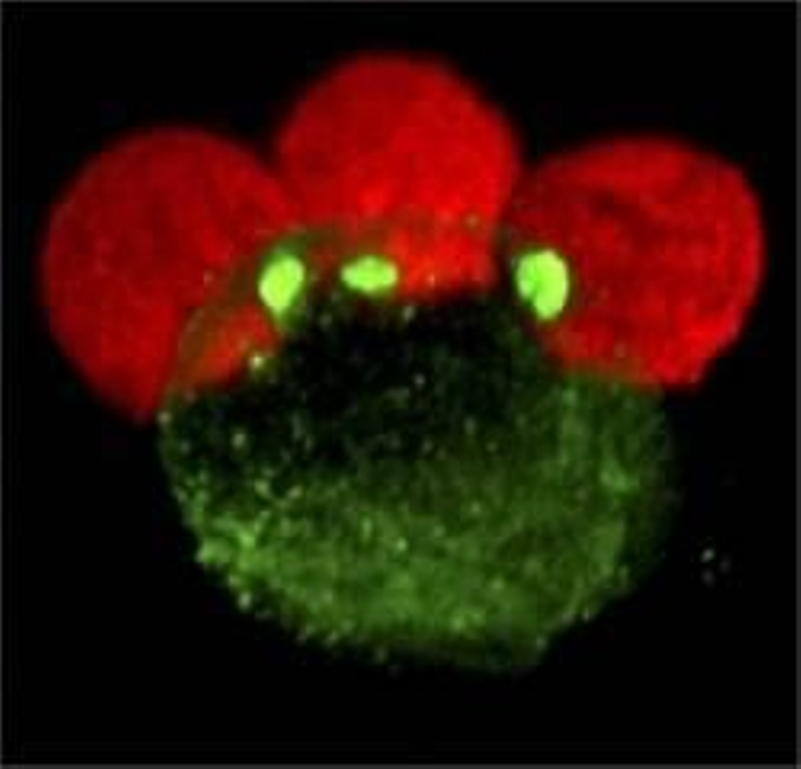 En la imagen, una célula infectada por el virus del Sida, unida a través de sinapsis virales a tres células sanas que terminará infectando. (Foto: EFE)