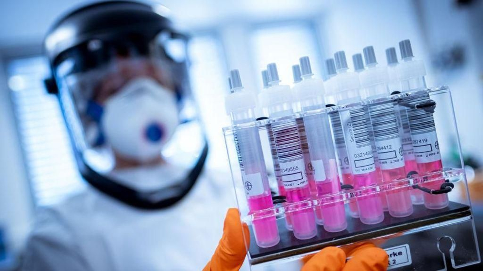 Un científico sostiene varias muestras serológicas en su investigación de una vacuna frente al coronavirus.