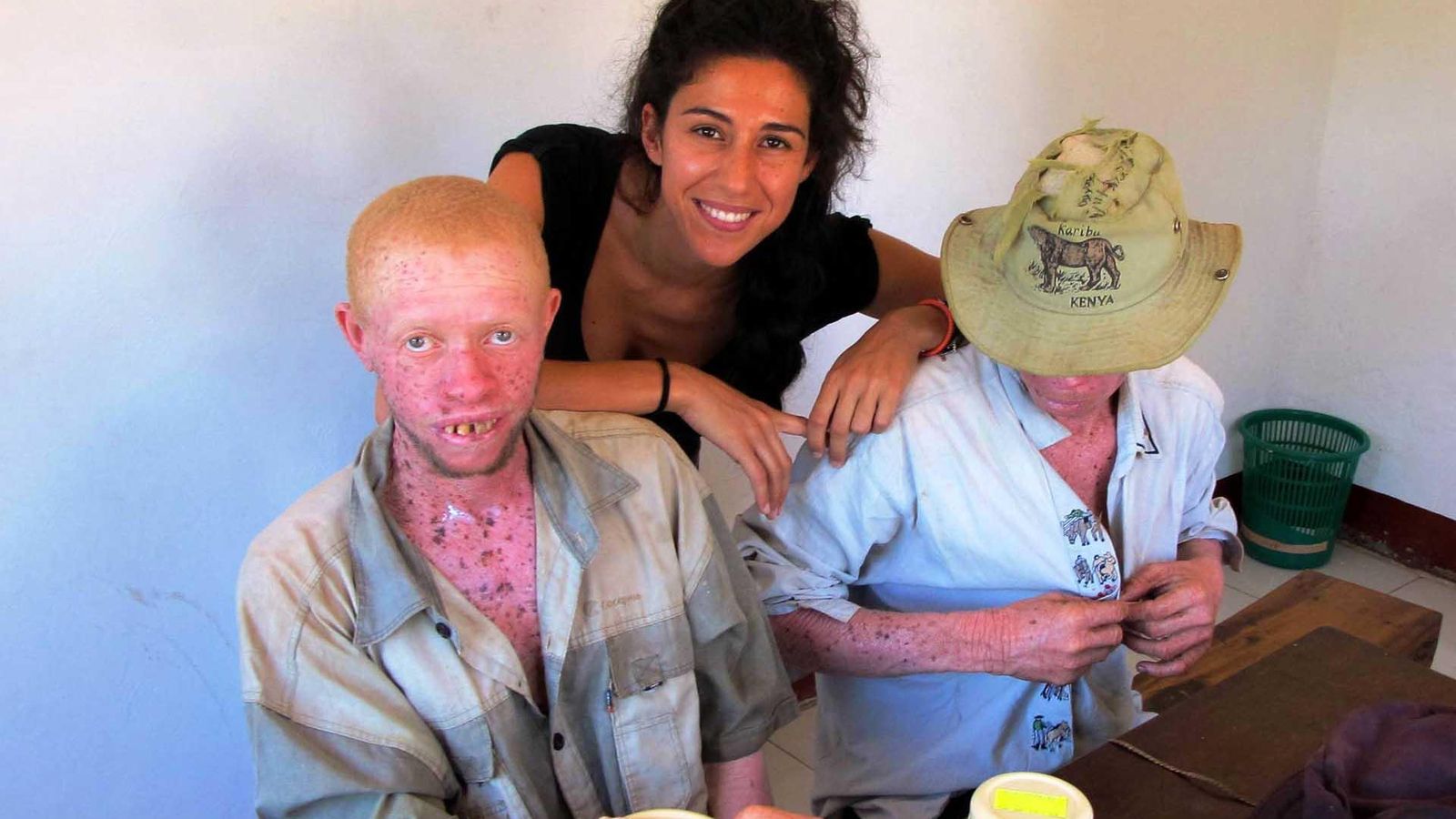 Mafalda Soto albinos