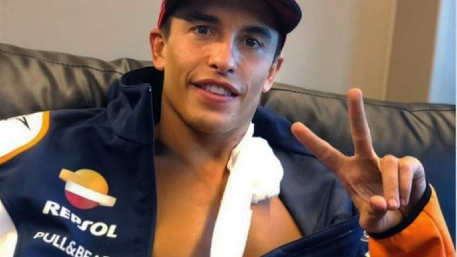 Marc Márquez (Repsol Honda RC 213 V), que sufrió una caída casi al final del Gran Premio de España de MotoGP, se ha producido "la fractura completa del tercio medio del húmero del brazo derecho