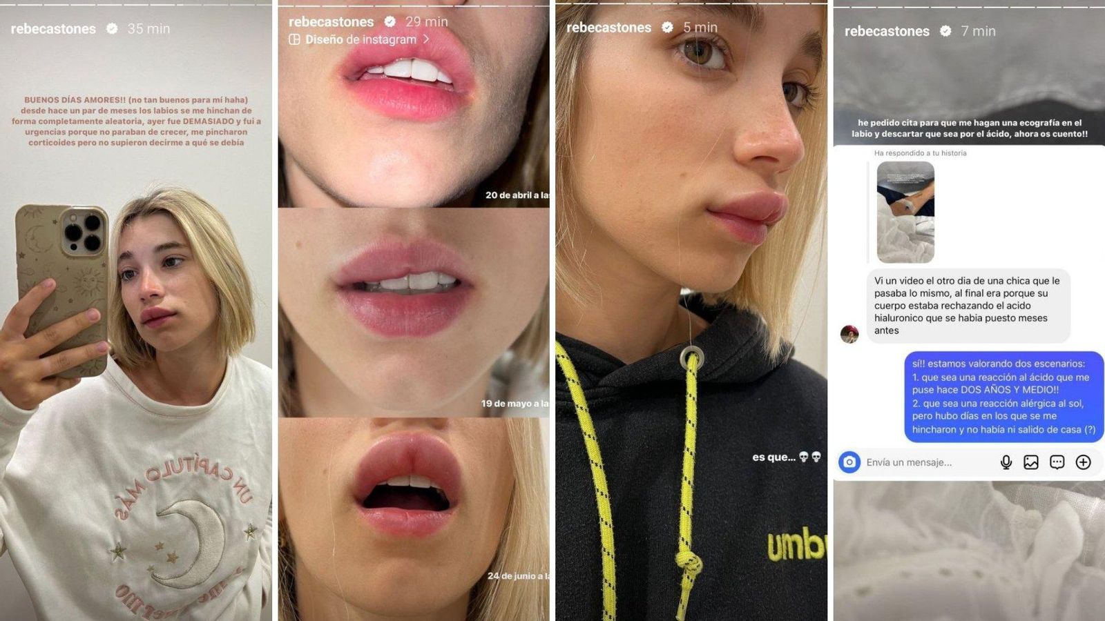 Historias de Rebeca Stones en Instagram.