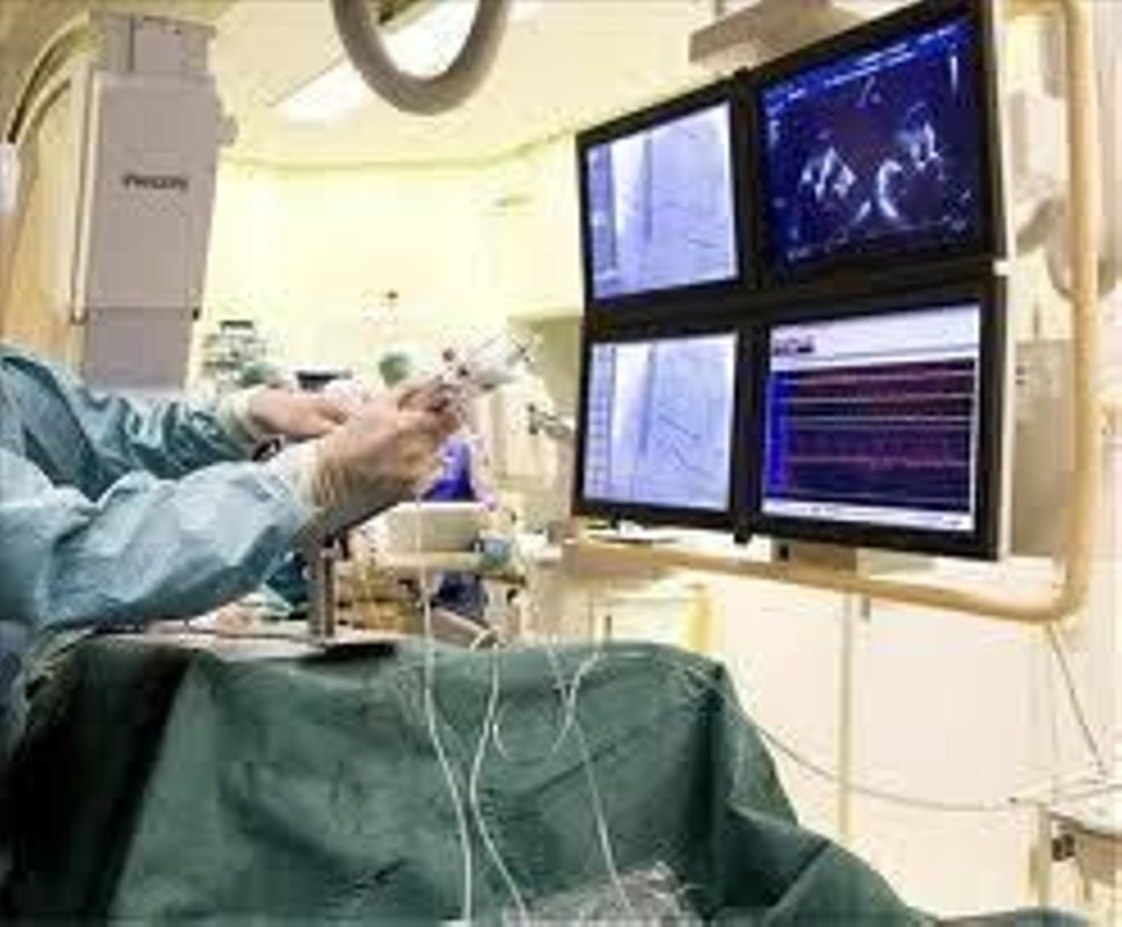 Material quirúrgico.