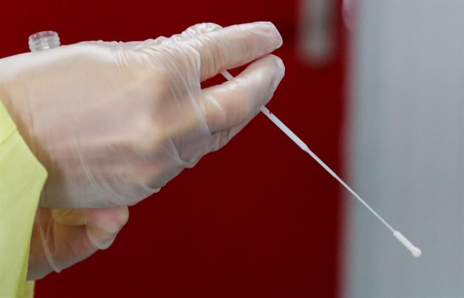 Sanidad informa de 15.186 nuevos contagios de covid y 222 muertes más