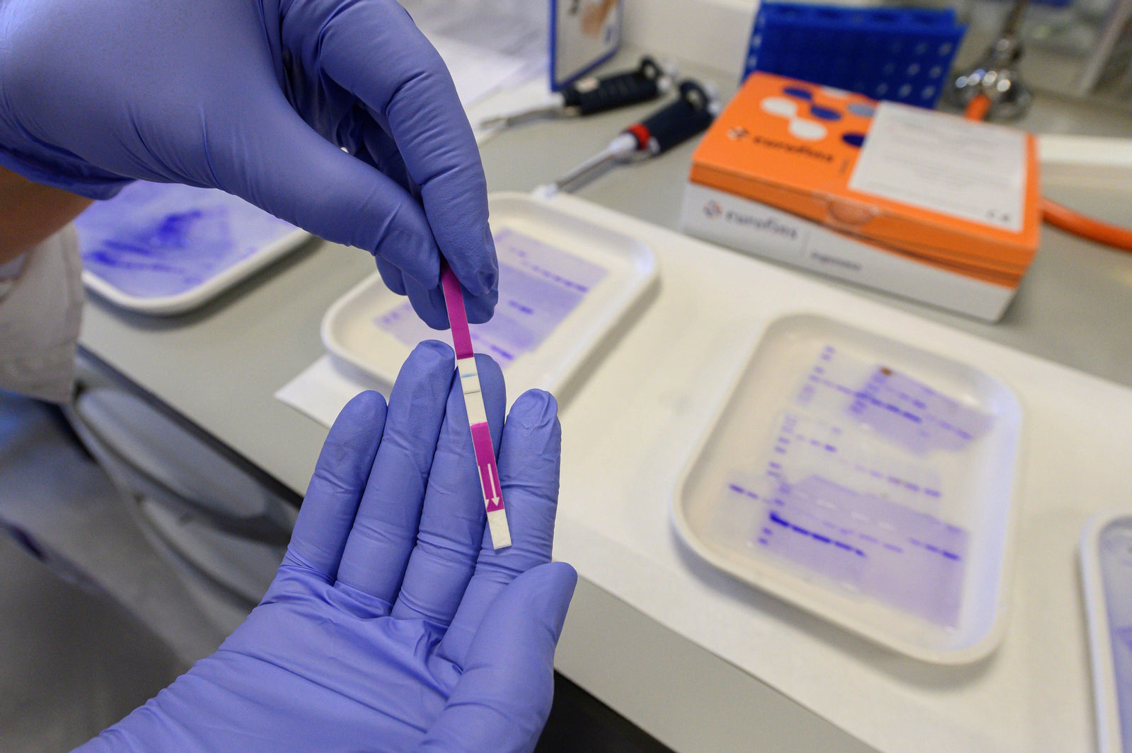 Dieciocho positivos tras un brote de COVID-19 en una residencia de Lleida