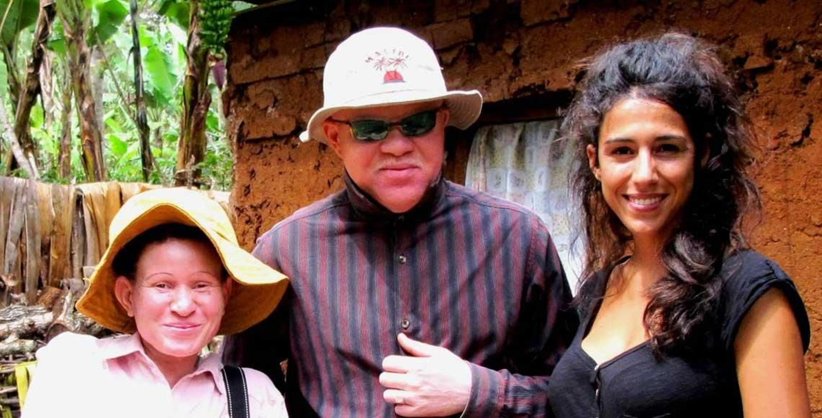 El trabajo de Mafalda y todo su equipo con los albinos africanos ha abierto una puerta de esperanzaa a esta comunidad.