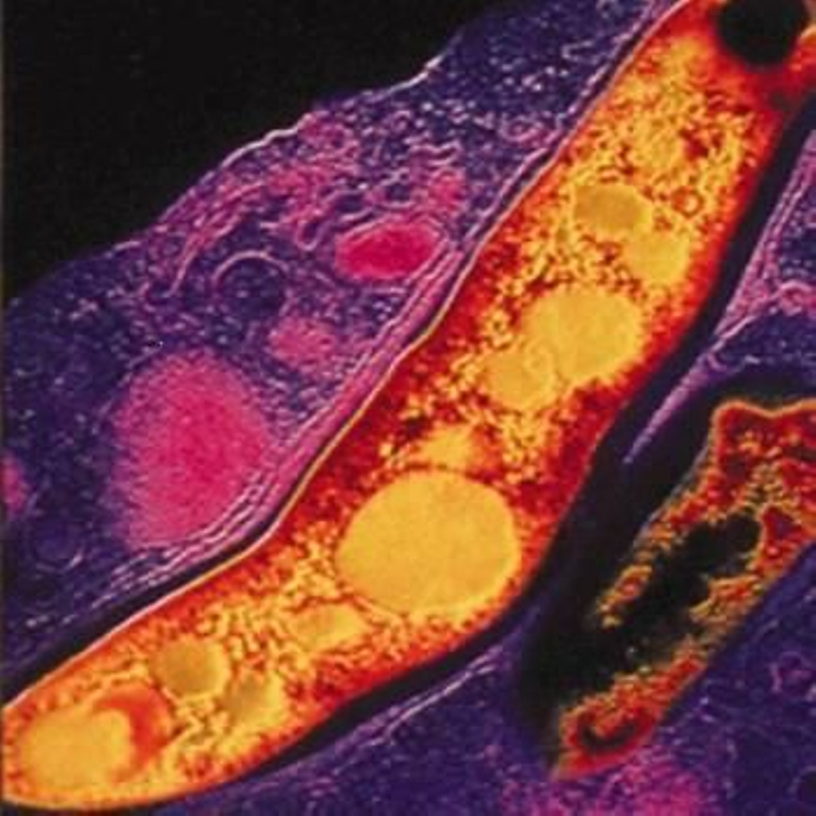 Mycobacteria responsable de la tuberculosis