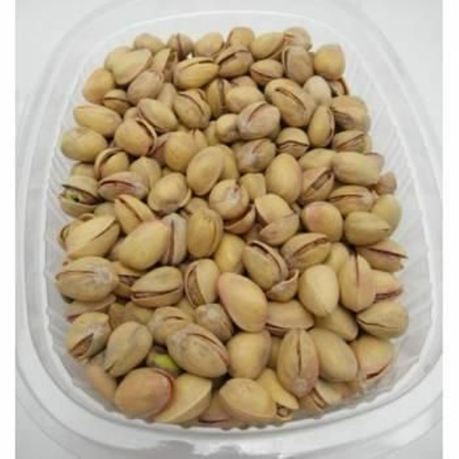 La dieta es un factor importante en la prevención de la enfermedad. (Foto: ARCHIVO)