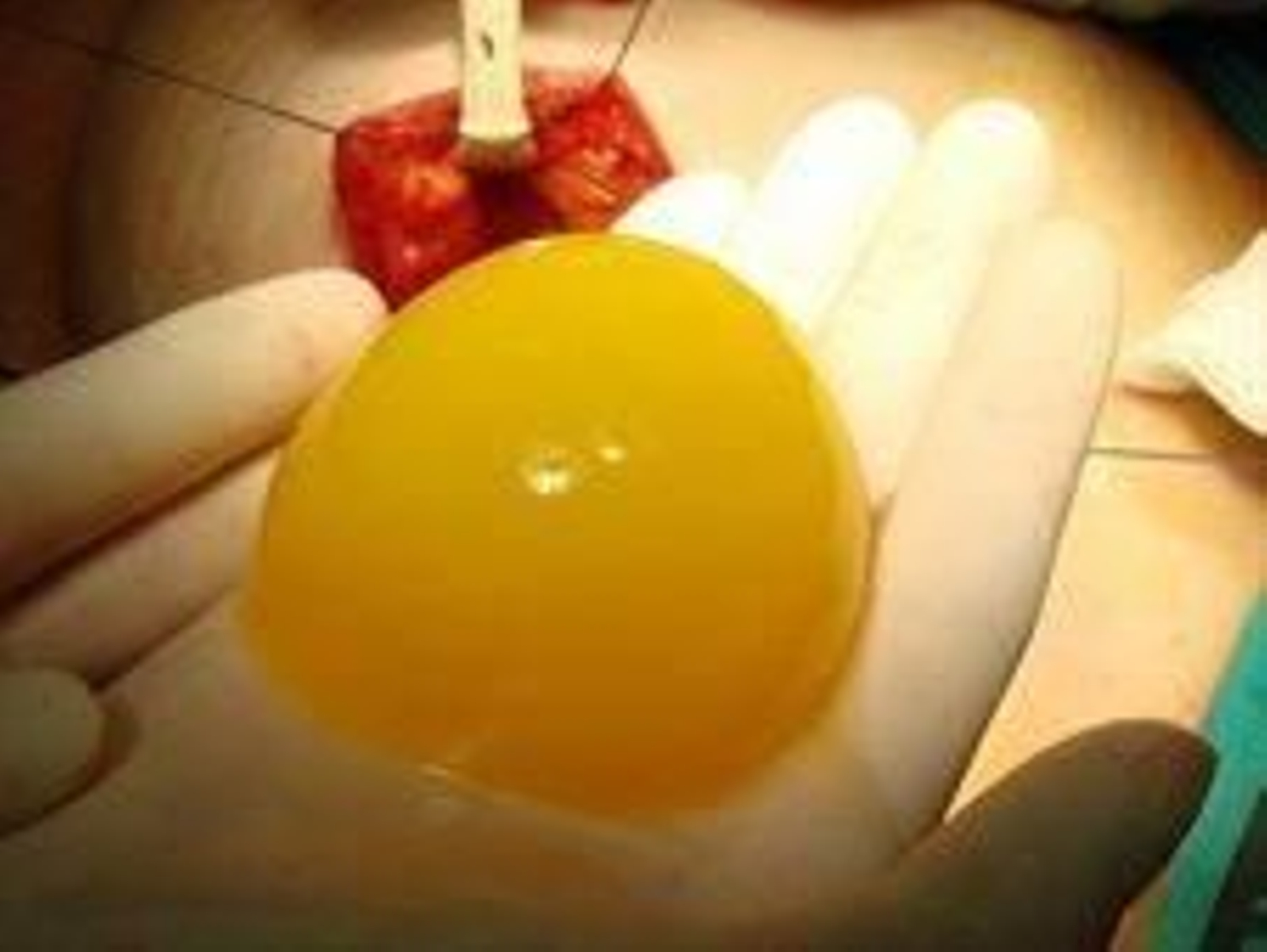 Foto: HOSPITAL GERMANS TRIAS I PUJOL